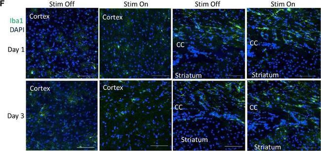 Rabbit IgG (H+L) Highly Cross-Adsorbed Secondary Antibody in Immunohistochemistry (IHC)