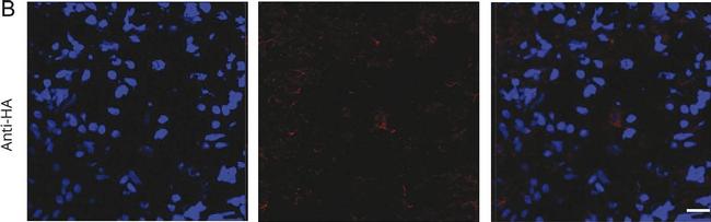 Mouse IgG (H+L) Cross-Adsorbed Secondary Antibody in Immunohistochemistry (IHC)