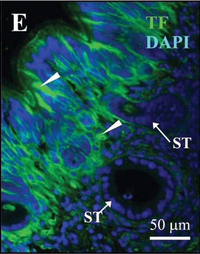 Guinea Pig IgG (H+L) Highly Cross-Adsorbed Secondary Antibody in Immunohistochemistry (IHC)