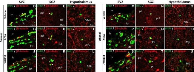 Rat IgG (H+L) Highly Cross-Adsorbed Secondary Antibody in Immunohistochemistry (IHC)