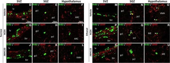 Rat IgG (H+L) Highly Cross-Adsorbed Secondary Antibody in Immunohistochemistry (IHC)