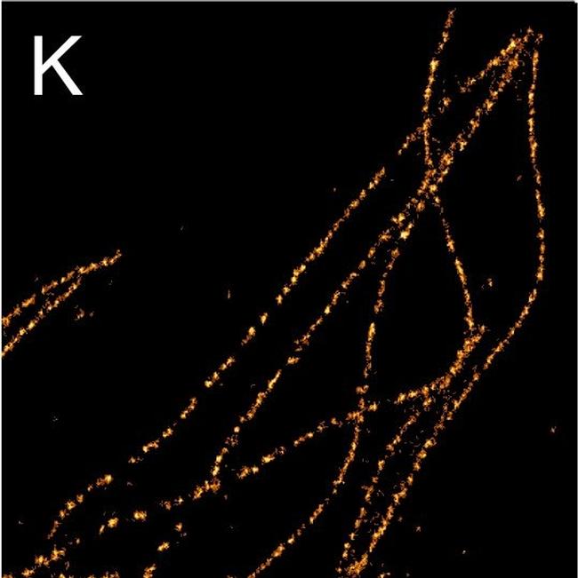 Rabbit IgG (H+L) Highly Cross-Adsorbed Secondary Antibody in Immunocytochemistry (ICC/IF)