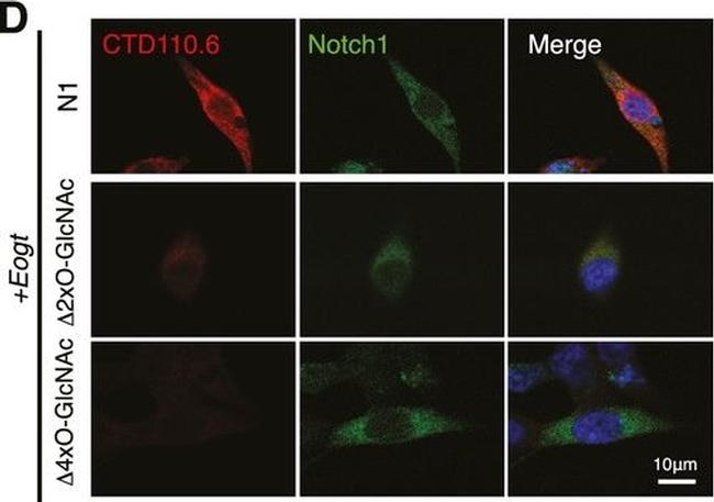 Mouse IgM (Heavy chain) Cross-Adsorbed Secondary Antibody in Immunocytochemistry (ICC/IF)