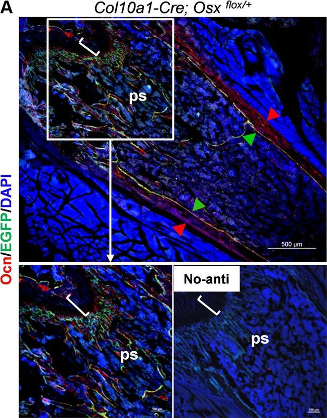 Rabbit IgG (H+L) Cross-Adsorbed Secondary Antibody in Immunohistochemistry (IHC)