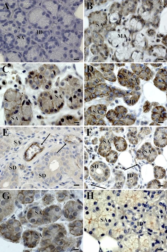 Claudin 2 Antibody in Immunohistochemistry (IHC)