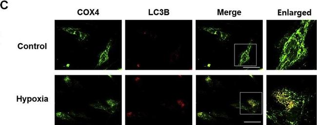 Rabbit IgG (H+L) Highly Cross-Adsorbed Secondary Antibody in Immunocytochemistry (ICC/IF)