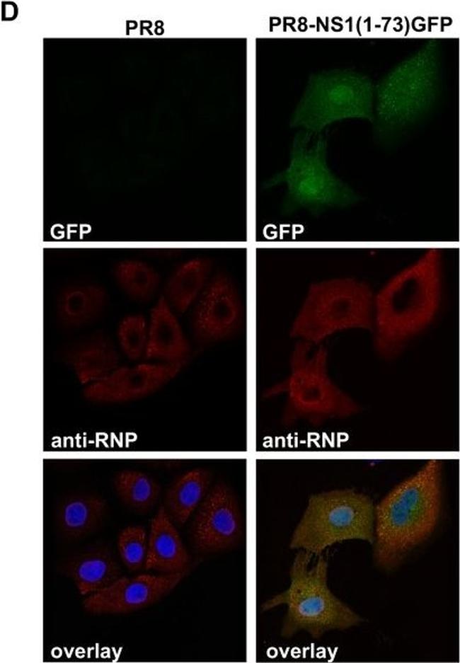 Goat IgG (H+L) Cross-Adsorbed Secondary Antibody in Immunocytochemistry (ICC/IF)