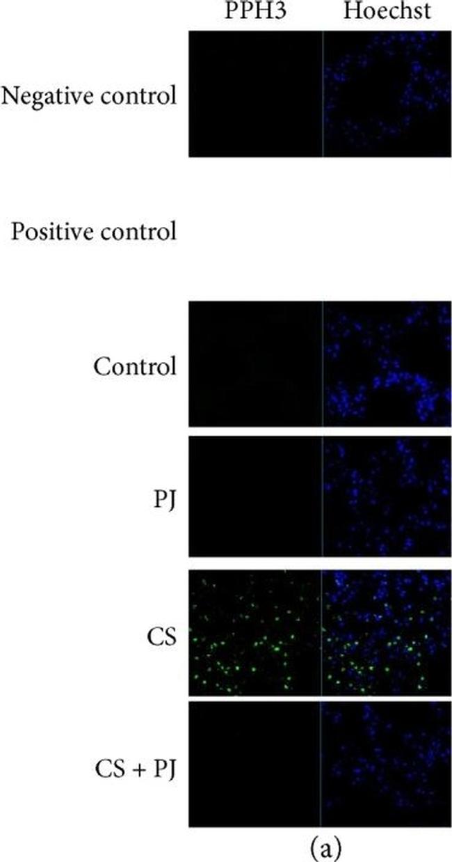 Rabbit IgG (H+L) Cross-Adsorbed Secondary Antibody in Immunohistochemistry (IHC)