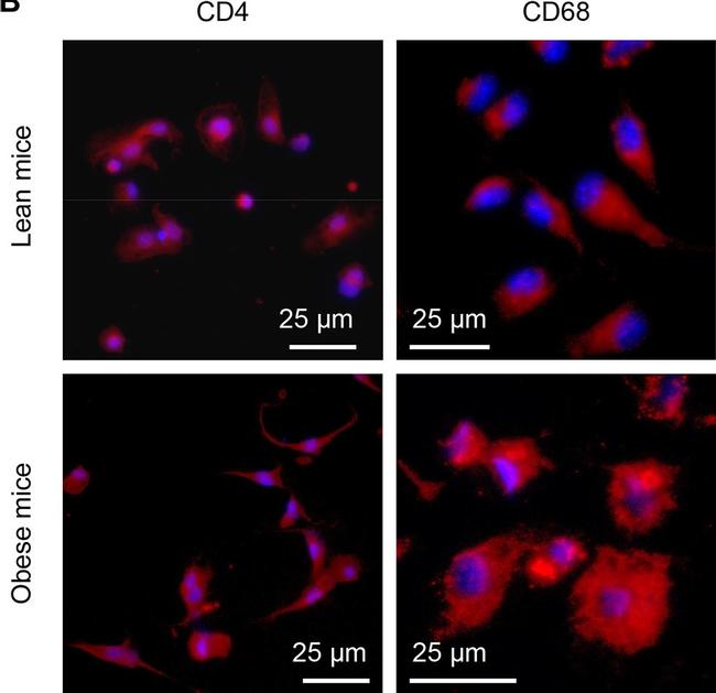 Rabbit IgG (H+L) Cross-Adsorbed Secondary Antibody in Immunocytochemistry (ICC/IF)