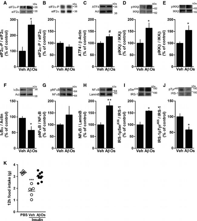 Phospho-IRS1 (Ser312) Antibody