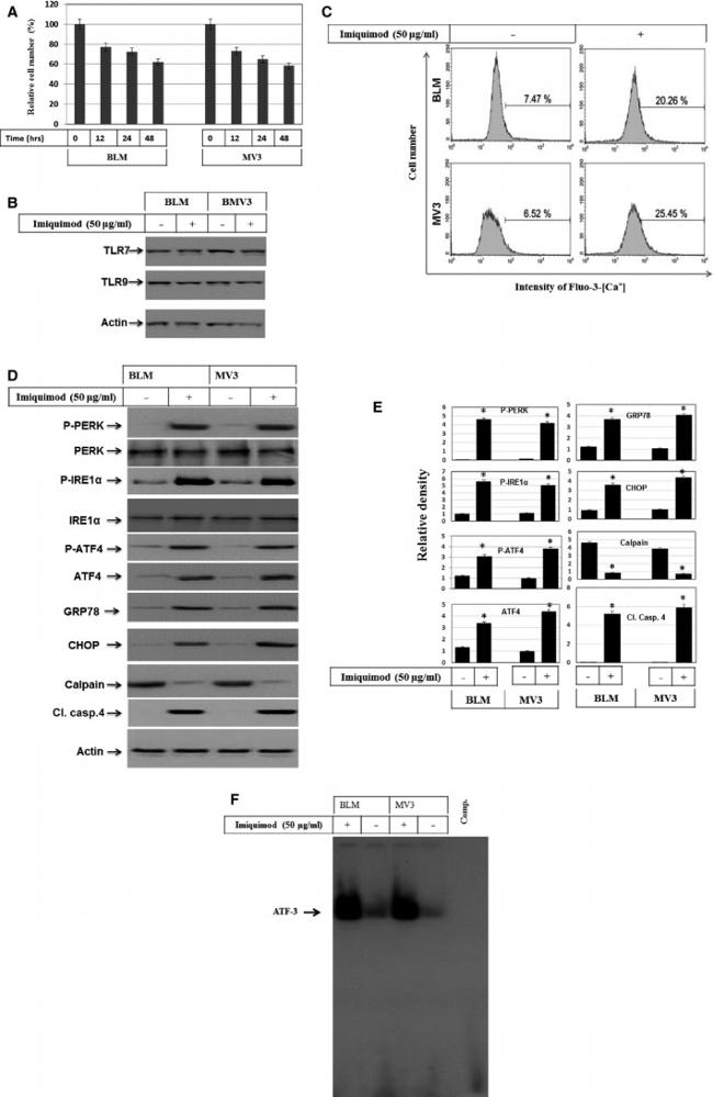 Phospho-IRE1 alpha (Ser724) Antibody