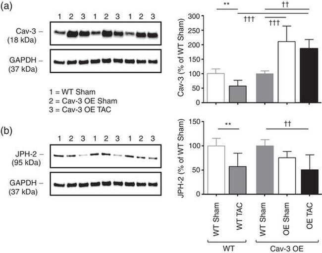 JPH2 Antibody in Western Blot (WB)