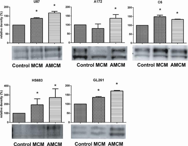 Phospho-PYK2 (Tyr579, Tyr580) Antibody