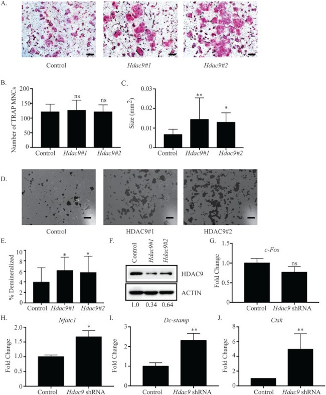 HDAC9 Antibody