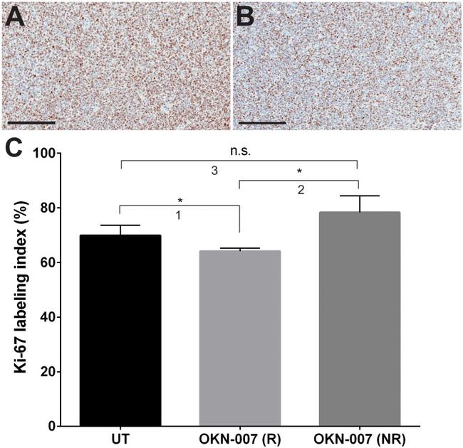 Ki-67 Antibody