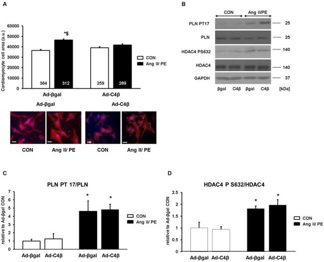 Phospholamban Antibody