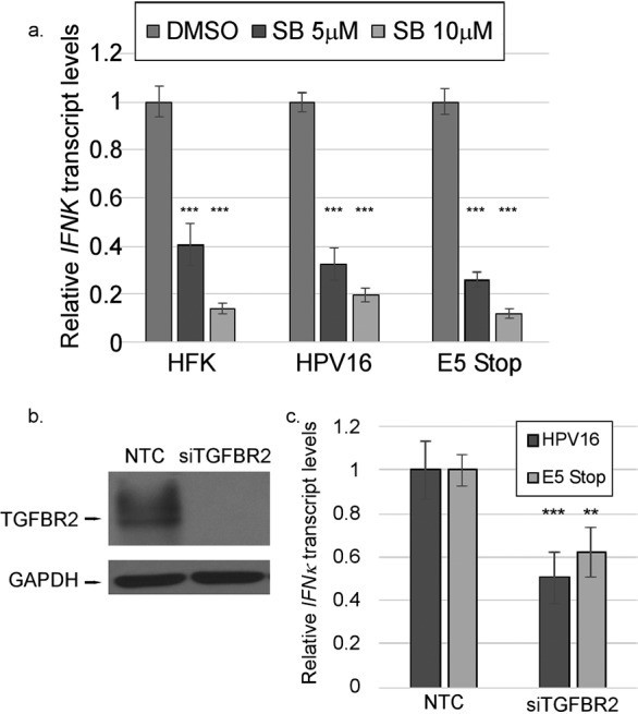 TGFBR2 Antibody