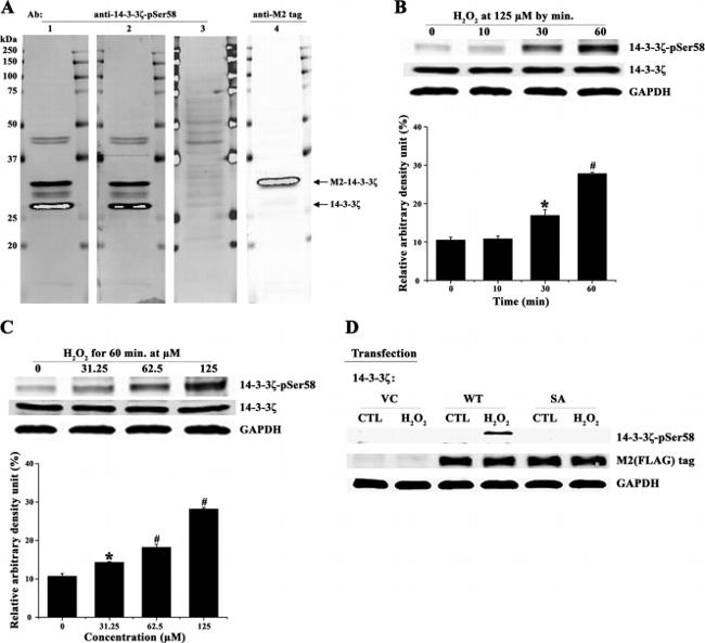 Phospho-14-3-3 beta (Ser58) Antibody