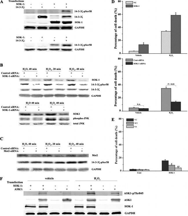 Phospho-14-3-3 beta (Ser58) Antibody