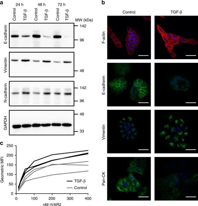 Pan Cytokeratin Antibody