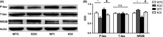 Phospho-Tau (Ser262) Antibody