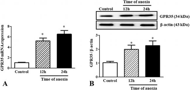 GPR35 Antibody