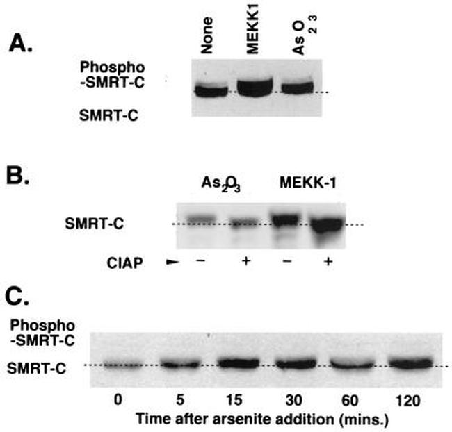 NCoR2 Antibody