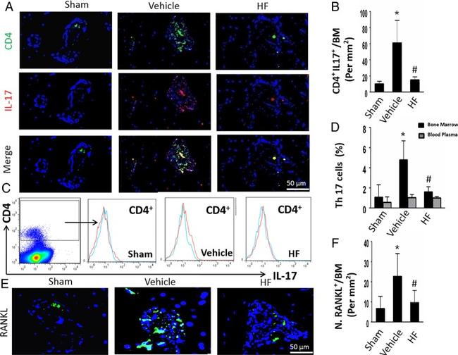 CD4 Antibody