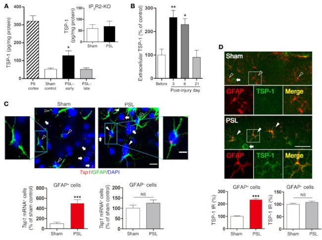 Thrombospondin 1 Antibody