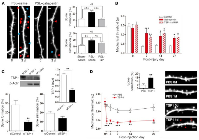 Thrombospondin 1 Antibody