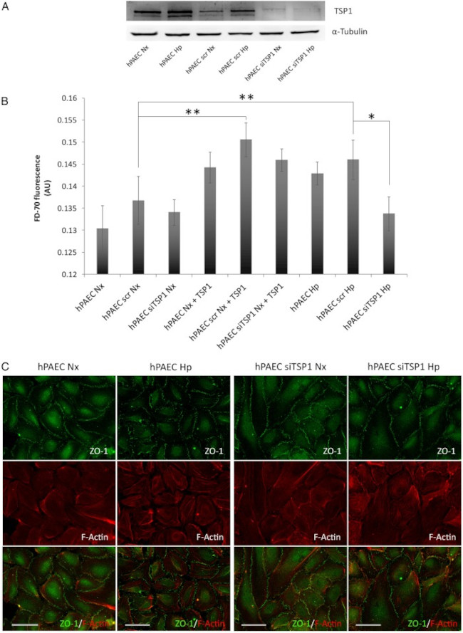 Thrombospondin 1 Antibody