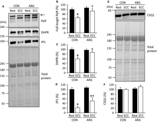 CaV1.1 Antibody in Western Blot (WB)