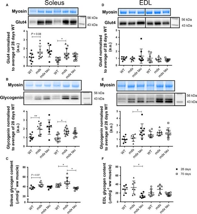 GLUT4 Antibody in Western Blot (WB)