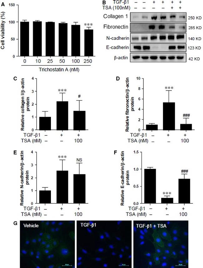 Fibronectin Antibody in Western Blot (WB)