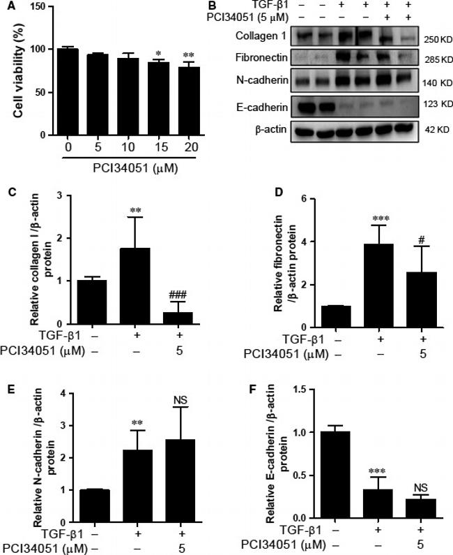 Fibronectin Antibody in Western Blot (WB)