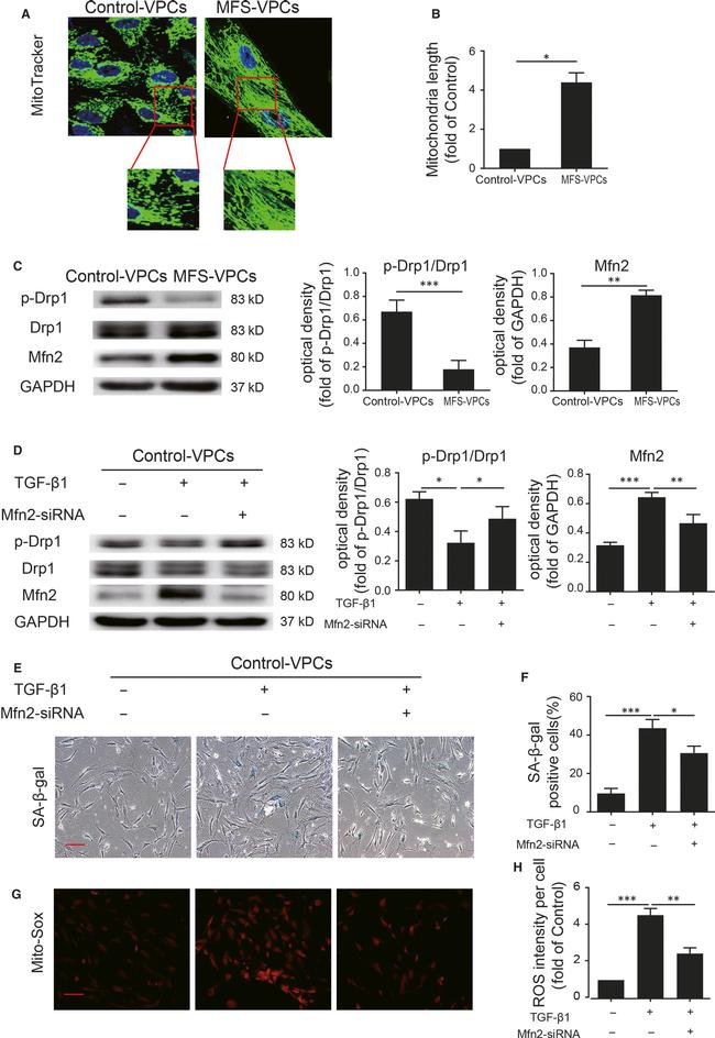 Phospho-DRP1 (Ser616) Antibody