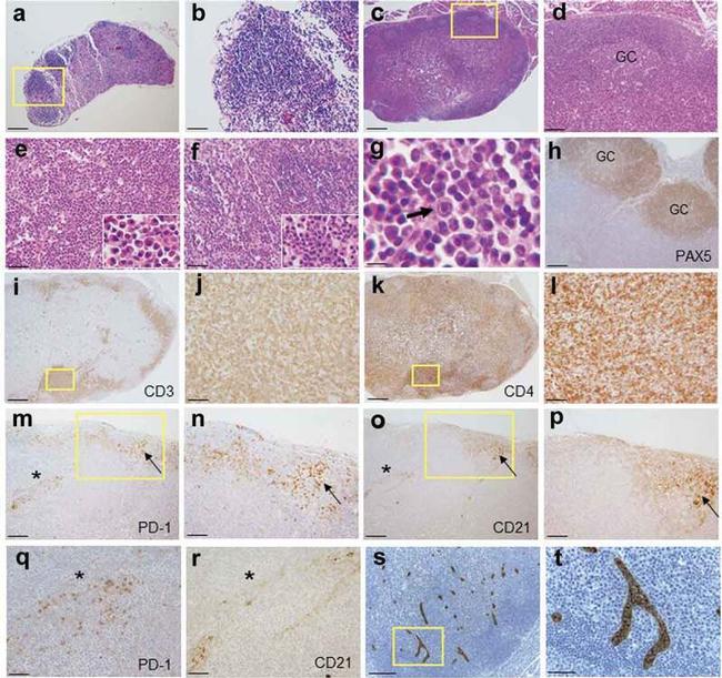 CD4 Antibody in Immunohistochemistry (IHC)