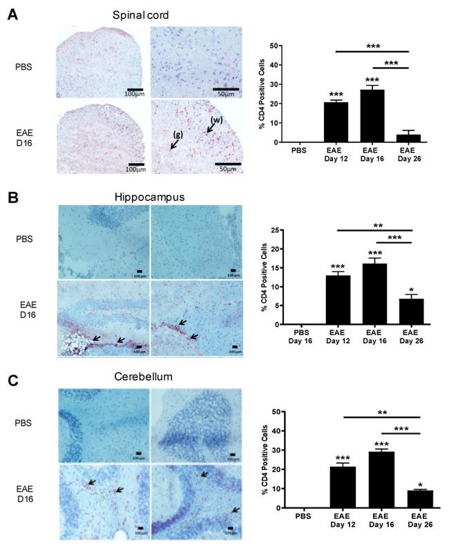 CD4 Antibody in Immunohistochemistry (Frozen) (IHC (F))