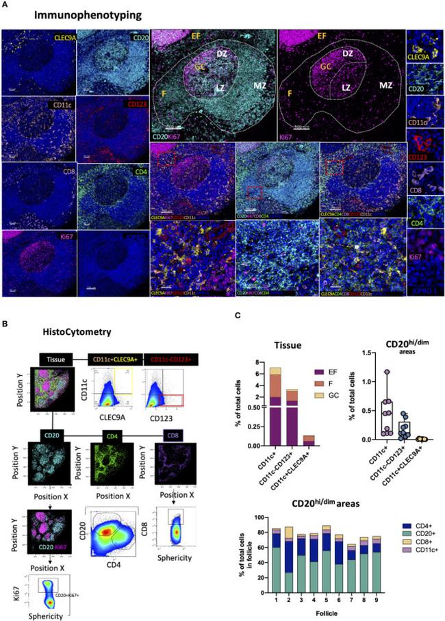 CD20 Antibody in Immunohistochemistry (IHC)