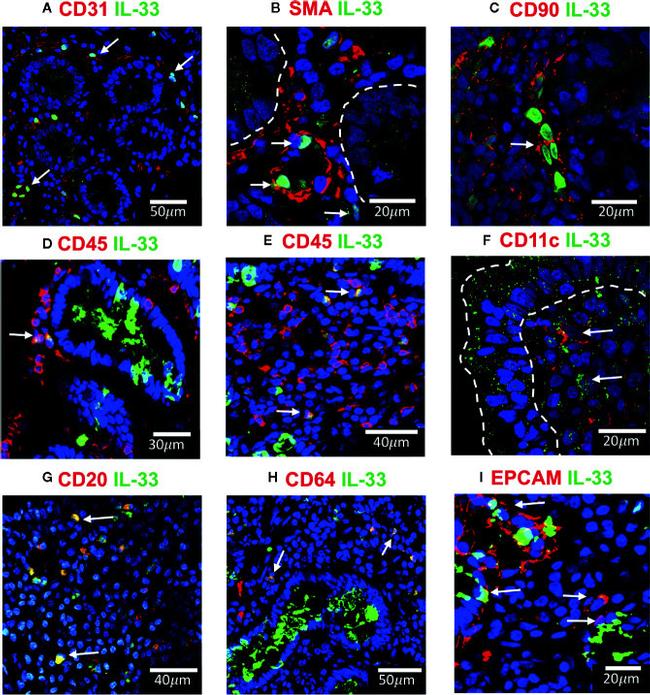 CD20 Antibody in Immunohistochemistry (IHC)