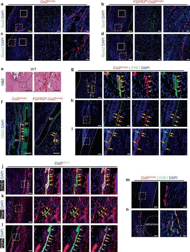 LYVE1 Antibody in Immunohistochemistry (PFA fixed) (IHC (PFA))