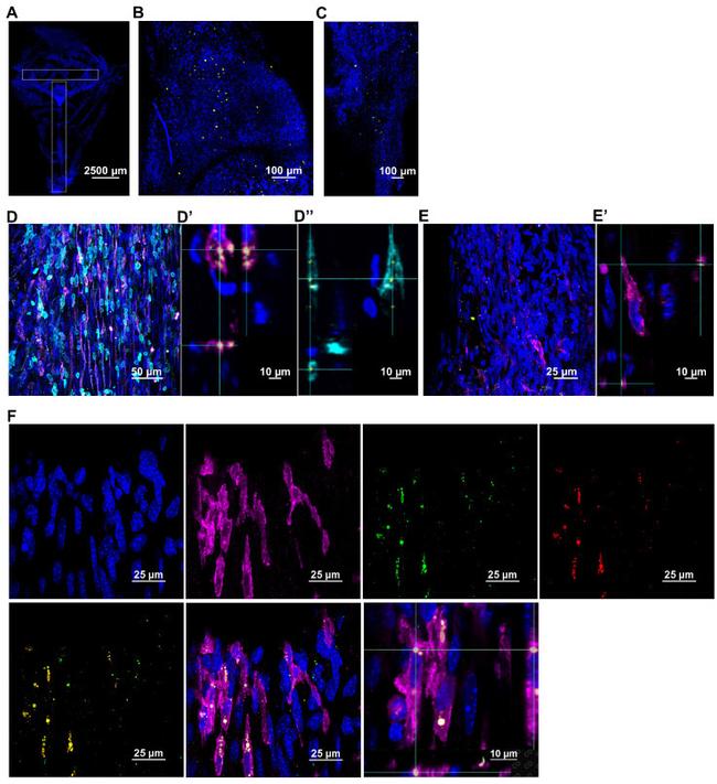 LYVE1 Antibody in Immunohistochemistry (PFA fixed) (IHC (PFA))