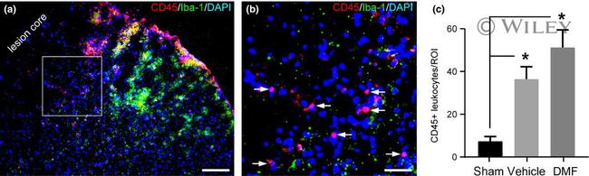 CD45 Antibody in Immunohistochemistry (IHC)