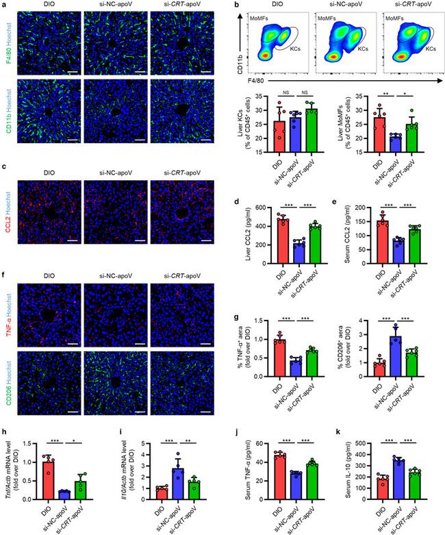 CCL2 (MCP-1) Antibody in Immunohistochemistry (IHC)