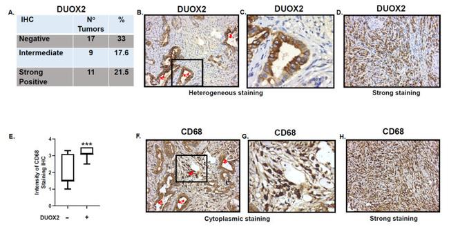 CD68 Antibody in Immunohistochemistry (IHC)