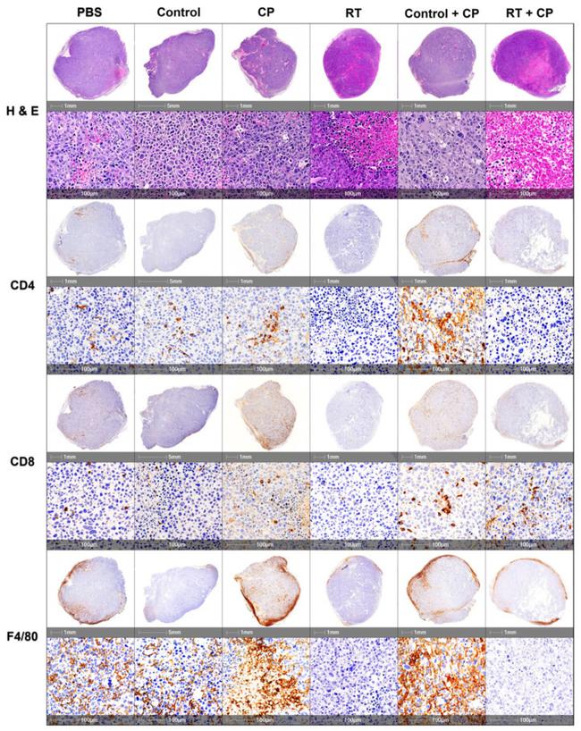 CD4 Antibody in Immunohistochemistry (IHC)