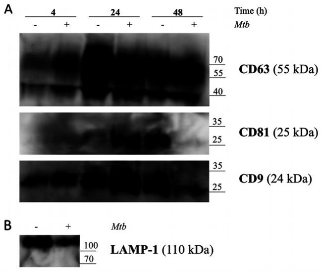 CD107a (LAMP-1) Antibody in Western Blot (WB)