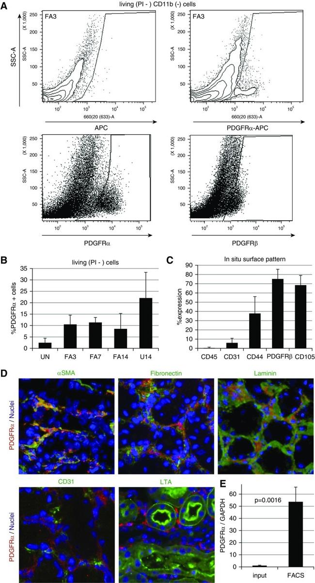 CD140a (PDGFRA) Antibody in Immunohistochemistry (IHC)