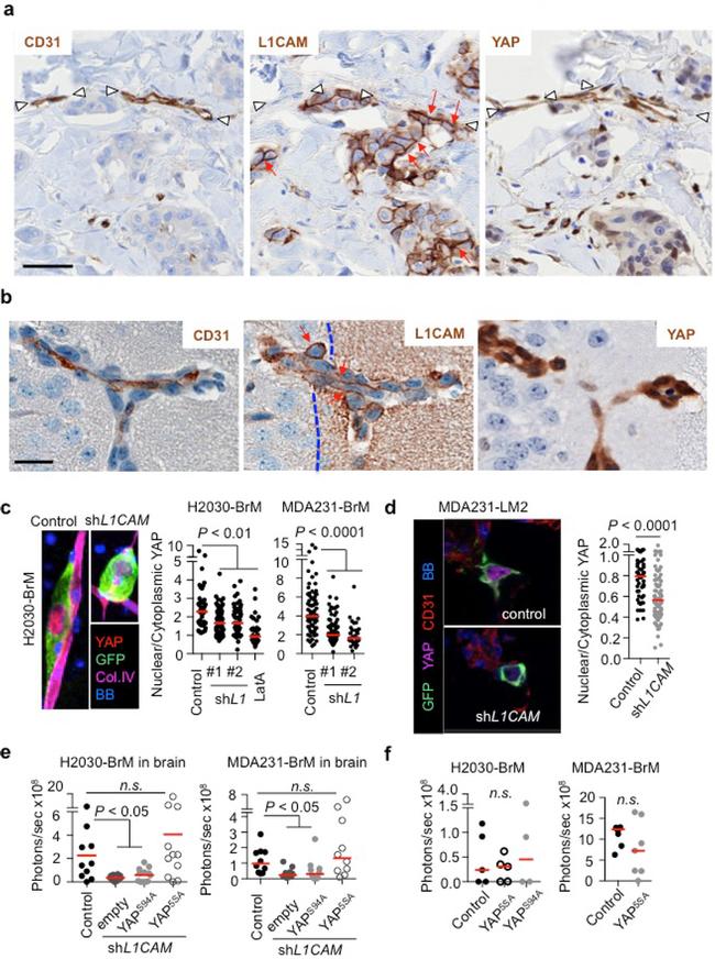 CD171 Antibody in Immunohistochemistry (IHC)