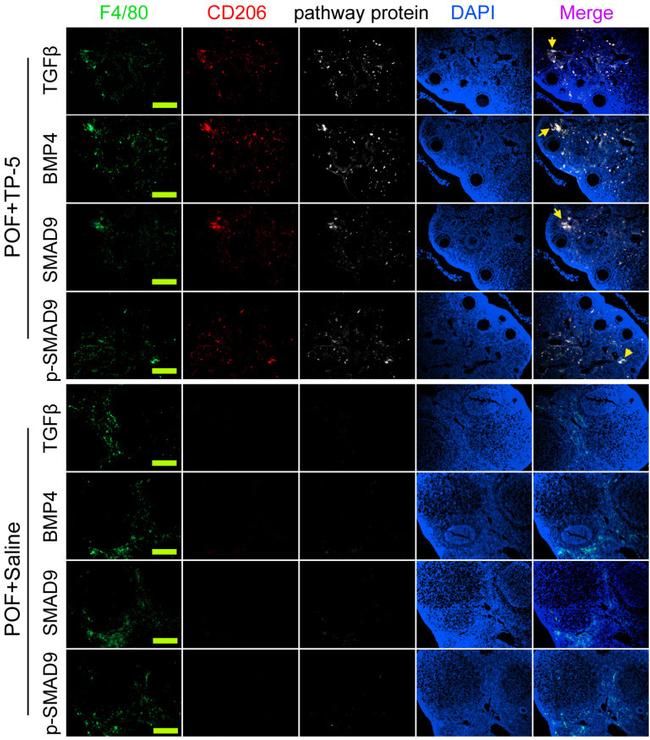 CD206 (MMR) Antibody in Immunocytochemistry (ICC/IF)